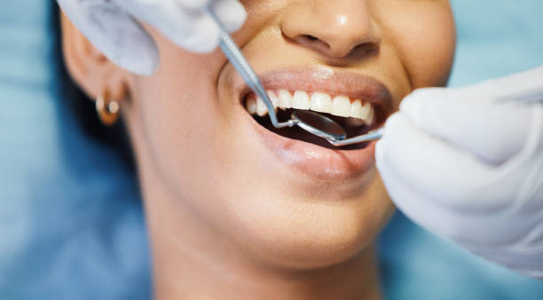 Best Chipped Tooth Repair Near Me  in Lynnwood, WA
